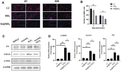 Porous Se@SiO2 Nanoparticles Enhance Wound Healing by ROS-PI3K/Akt Pathway in Dermal Fibroblasts and Reduce Scar Formation